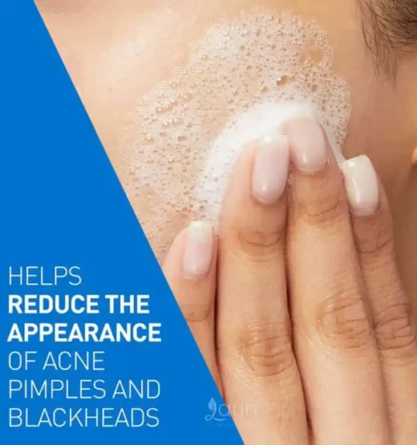 Cerave Acne Control Cleanser 355ml (Canadian Version) - Image 2